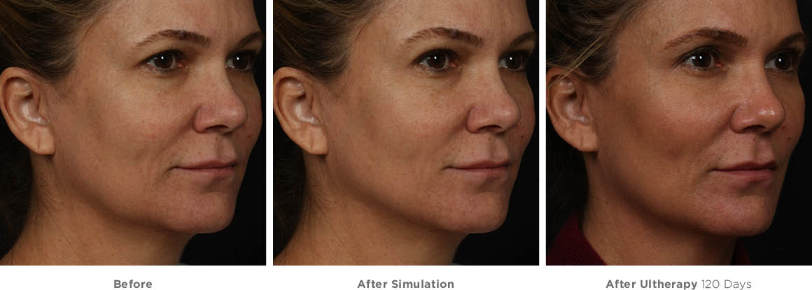 Cưỡng bức đàn ông để cướp tinh trùng