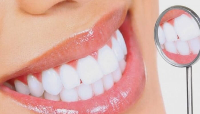 Để mang lại nụ cười đẹp cần biết cách để vệ sinh phương pháp làm trắng răng này